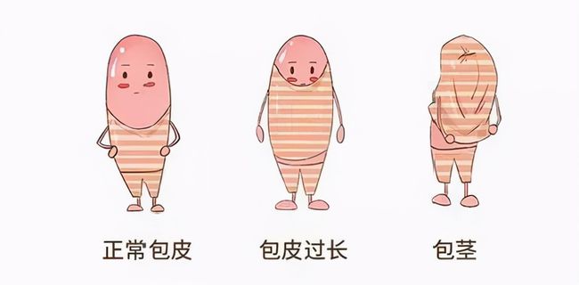 儿童包皮一定要切吗,好博在线