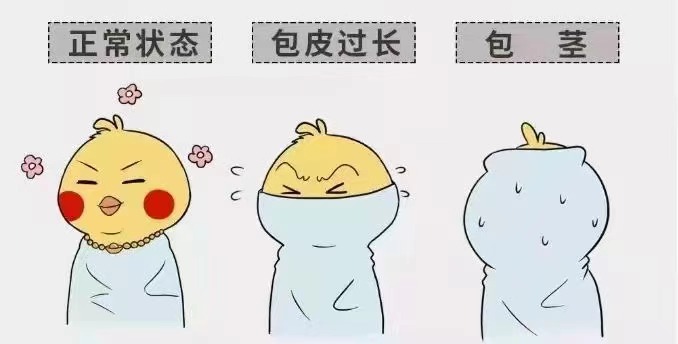 齐齐哈尔包皮包茎好博在线